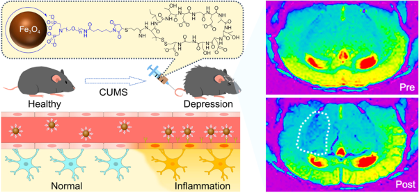 Visualizing the spatial distribution of inflammation in the depressed brain with a targeted MRI nanoprobe in vivo