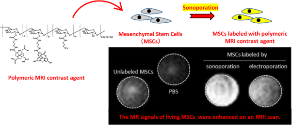 Sonoporation-based labeling of mesenchymal stem cells with polymeric MRI contrast agents for live-cell tracking