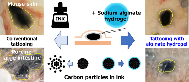 Application of a sodium alginate hydrogel for clear preoperative endoscopic marking using India ink