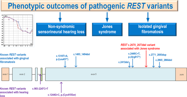 Pathogenic <i>REST</i> variant causing Jones syndrome and a review of the literature
