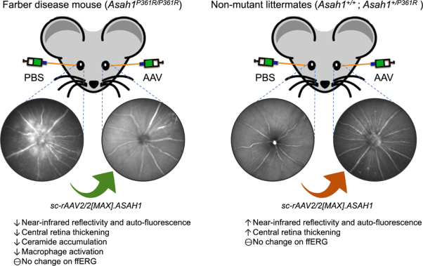 rAAV-mediated over-expression of acid ceramidase prevents retinopathy in a mouse model of Farber lipogranulomatosis