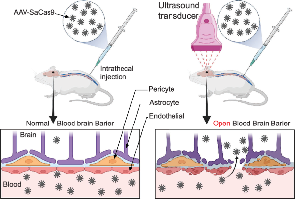 Focused ultrasound widely broadens AAV-delivered Cas9 distribution and activity