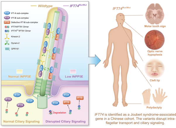 Disrupted intraflagellar transport due to <i>IFT74</i> variants causes Joubert syndrome
