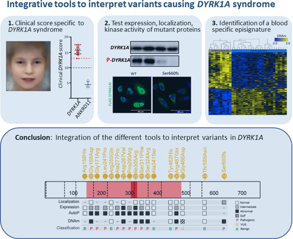 Integrative approach to interpret <i>DYRK1A</i> variants, leading to a frequent neurodevelopmental disorder