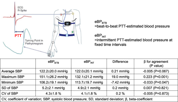 Pulse transit time-estimated blood pressure: a comparison of beat-to-beat and intermittent measurement