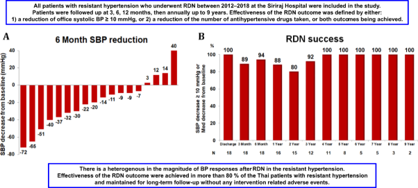 Long-term outcome of renal nerve denervation (RDN) for resistant hypertension