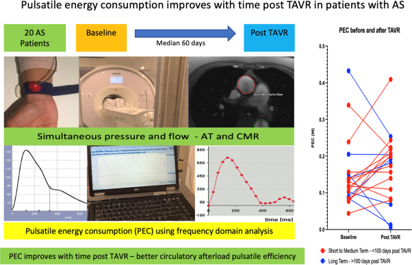 Pulsatile energy consumption as a surrogate marker for vascular afterload improves with time post transcatheter aortic valve replacement in patients with aortic stenosis