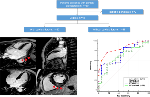 Non-invasive left ventricular pressure-strain loop study on cardiac fibrosis in primary aldosteronism: a comparative study with cardiac magnetic resonance imaging