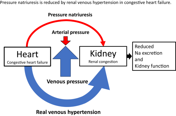 Renal venous hypertension to the regulation of pressure natriuresis in heart failure