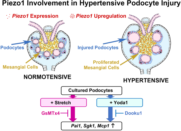 Roles of the mechanosensitive ion channel Piezo1 in the renal podocyte injury of experimental hypertensive nephropathy