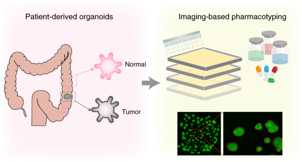 Organoid screening reveals epigenetic vulnerabilities in human colorectal cancer