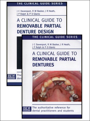 The removable partial denture equation