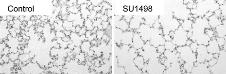Su1498 Inhibits Alveolarization in Newborn Mice.