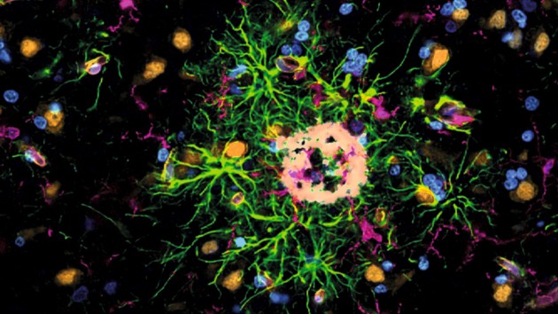 Nature Neuroscience cover