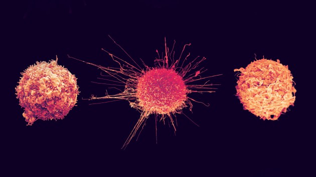Various types of cancer cells.