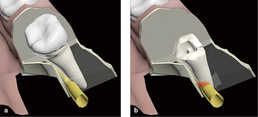 https://static-content.springer.com/image/chp%3A10.1007%2F978-90-368-0889-7_16/MediaObjects/333250_1_Nl_16_Fig4_HTML.jpg