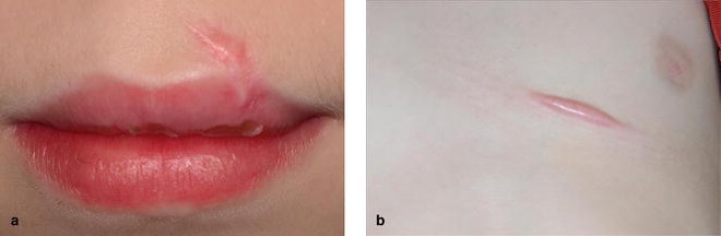 https://static-content.springer.com/image/chp%3A10.1007%2F978-90-368-1030-2_3/MediaObjects/346899_1_Nl_3_Fig5_HTML.jpg
