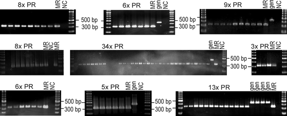 Expression And Localization Of Connexins In The Outer Retina Of The Mouse Springerlink