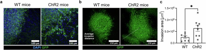 Neuronal activity-dependent mechanisms of small cell lung cancer ...