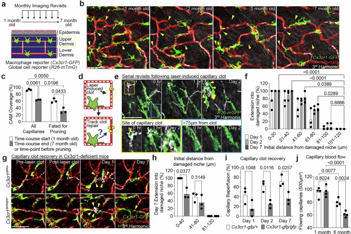 Niche-specific dermal macrophage loss promotes skin capillary ageing ...