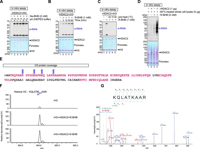 Kbhb Modification Spectrum Reversible histone deacetylase activity catalyzes lysine acylation ...