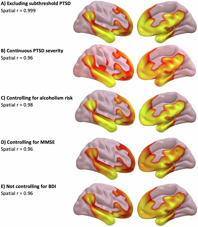 A potential target for noninvasive neuromodulation of PTSD symptoms ...