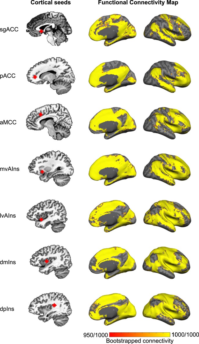 Cortical and subcortical mapping of the human allostatic–interoceptive ...
