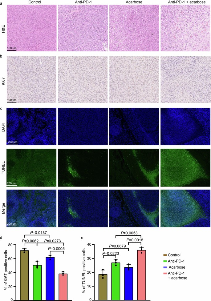 Acarbose enhances the efficacy of immunotherapy against solid tumours