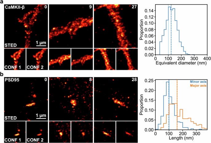 Dest Microscope Image Development of AI-assisted microscopy frameworks through realistic ...