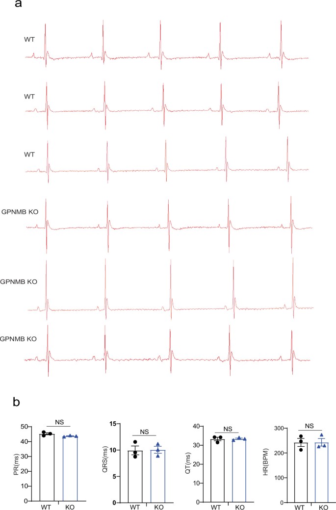Bonemarrow macrophagederived GPNMB protein binds to orphan receptor