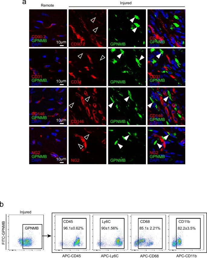 Bonemarrow macrophagederived GPNMB protein binds to orphan receptor