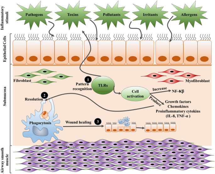 A review of inflammatory mechanism in airway diseases | SpringerLink