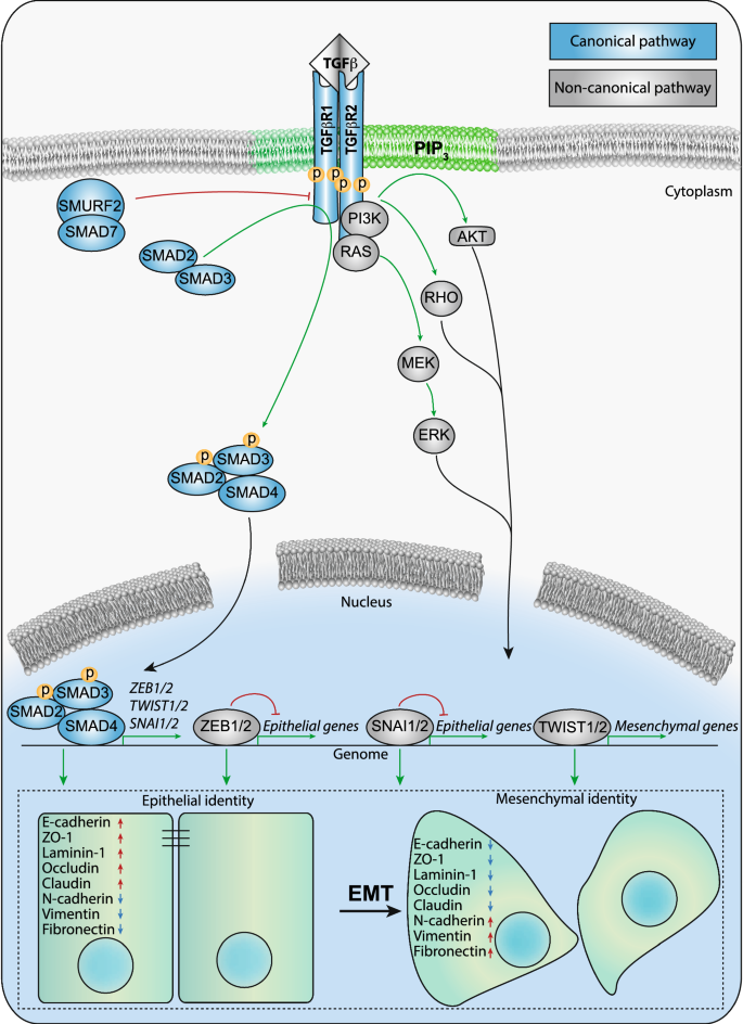 Tgfb Induced Metabolic Reprogramming During Epithelial To Mesenchymal Transition In Cancer Springerlink