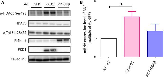 Phosphatidylinositol 4-kinase IIIβ mediates contraction-induced GLUT4  translocation and shows its anti-diabetic action in cardiomyocytes |  SpringerLink