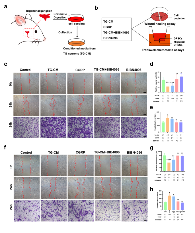 Sensory nerves drive migration of dental pulp stem cells via the CGRP ...