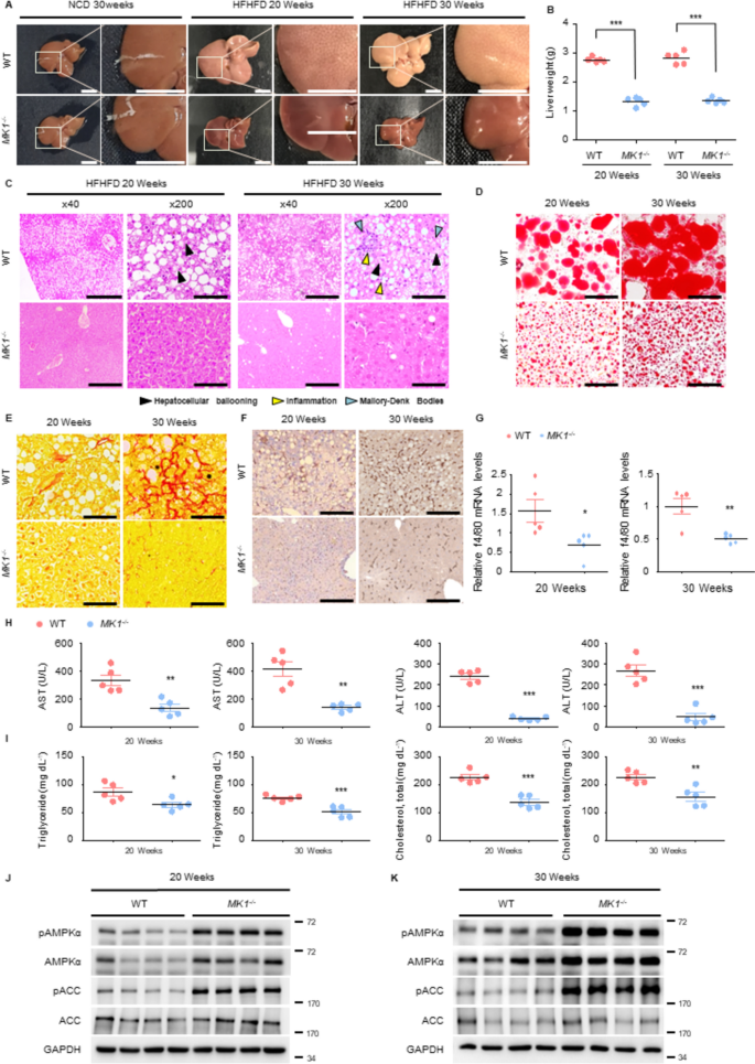 Mkrn1 Ebastine-mediated destabilization of E3 ligase MKRN1 protects against ...