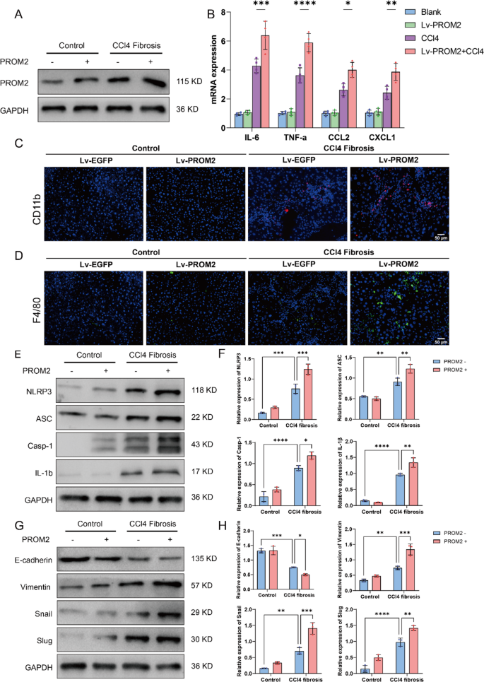 PROM2 exacerbates CCl4-Induced liver fibrosis via NLRP3 inflammasome ...