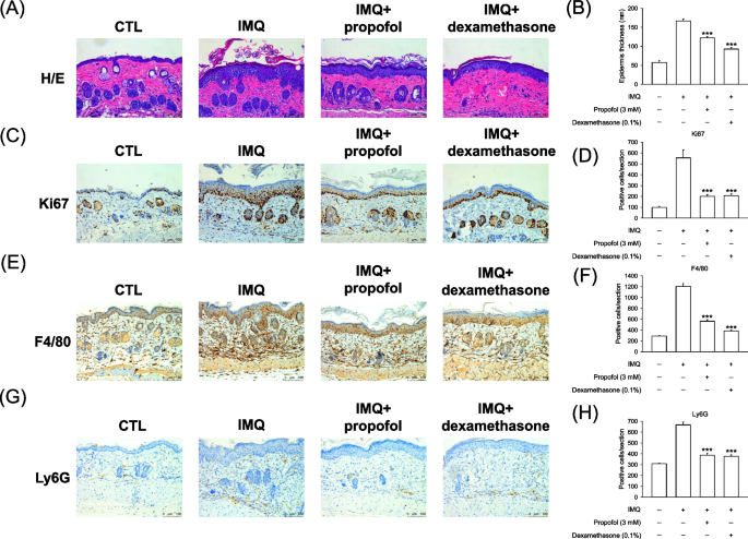 Skin delivery and anti-inflammatory effects of the anesthetic propofol ...
