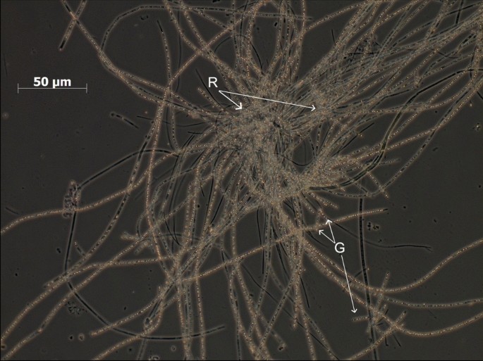 Thiothrix Bacterial fouling of Thiothrix sp. in hot springs of the Baikal Rift ...