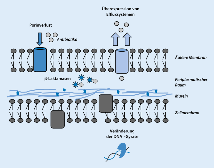 Multiresistente gramnegative Stäbchenbakterien auf der Intensivstation |  SpringerLink