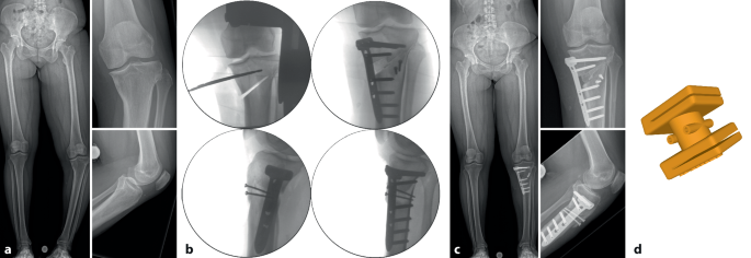 figure 17