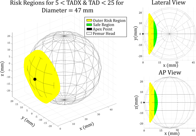 A Novel Lower Bound For Tip Apex Distance Springerlink