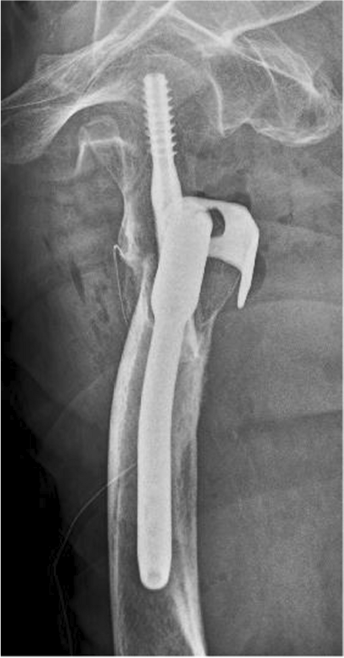 Project - Heads of Households. | PDF, image size:685x1312