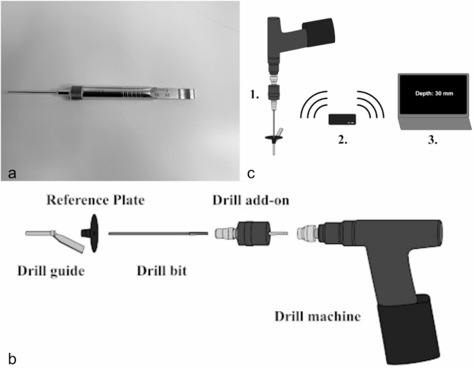Accuracy of a new innovative automatic sensor system (ADEPTH®) for ...