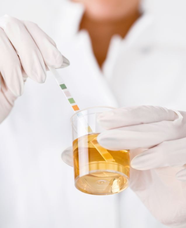 Eiweiß im Urin als wichtiger Risikoparameter nach akutem Nierenversagen |  SpringerLink