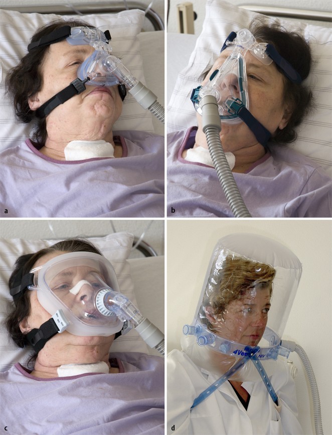 Nichtinvasive Beatmung als Therapie der akuten respiratorischen  Insuffizienz