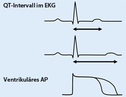 Long Qt Syndrom Springerlink