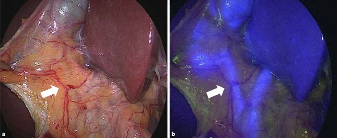 Intraoperative Mehrdimensionale Visualisierung Springerlink