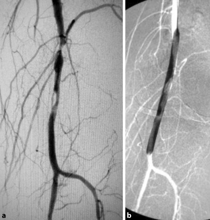Diabetisches Fußsyndrom – Teil 2 | SpringerLink