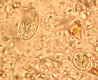 giardia mebendazol cum se îndepărtează papiloma în sine